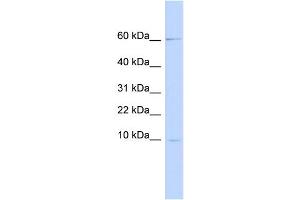 WB Suggested Anti-PI3 Antibody Titration:  0. (PI3 Antikörper  (Middle Region))