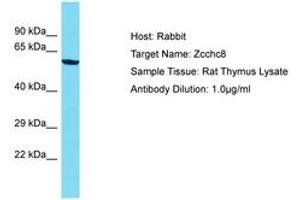 Image no. 1 for anti-Zinc Finger, CCHC Domain Containing 8 (ZCCHC8) (AA 246-295) antibody (ABIN6750376) (ZCCHC8 Antikörper  (AA 246-295))