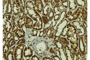 ABIN6278147 at 1/100 staining Mouse kidney tissue by IHC-P. (MAGEA1 Antikörper  (N-Term))
