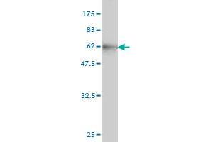 Western Blot detection against Immunogen (56. (CBR1 Antikörper  (AA 1-277))