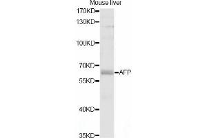 Western blot analysis of extracts of mouse liver, using AFP antibody (ABIN5997204) at 1/1000 dilution. (alpha Fetoprotein Antikörper)