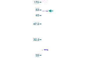 Image no. 1 for Aryl Hydrocarbon Receptor Interacting Protein-Like 1 (AIPL1) (AA 1-384) protein (GST tag) (ABIN1344677) (AIPL1 Protein (AA 1-384) (GST tag))