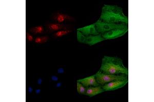ABIN7094619 and ABIN7098669 staining  cells by IF/ICC.