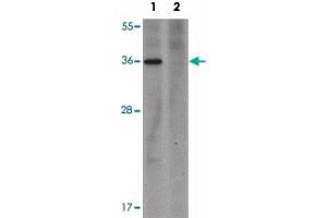 Western blot analysis of PLAC1 in human placenta tissue lysate with PLAC1 polyclonal antibody  at 1 ug/mL in (1) the absence and (2) the presence of blocking peptide. (PLAC1 Antikörper  (C-Term))