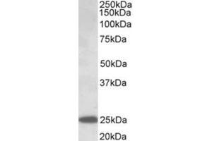 Western Blotting (WB) image for anti-Abhydrolase Domain Containing 14B (ABHD14B) (AA 188-200), (Internal Region) antibody (ABIN1105190) (ABHD14B Antikörper  (Internal Region))