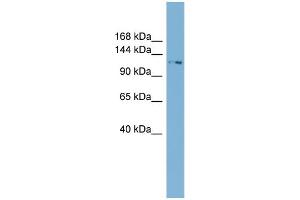 WB Suggested Anti-TTC17  Antibody Titration: 0. (TTC17 Antikörper  (N-Term))