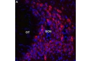 Expression of Melatonin receptor type 1B in rat supraoptic nucleusImmunohistochemical staining of perfusion-fixed frozen brain sections using Anti-Melatonin Receptor 1B (MTNR1B) Antibody (ABIN7043327, ABIN7044601 and ABIN7044602), (1:600), (red).