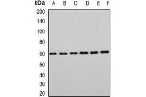 Western blot analysis of EYA3 expression in Hela (A), HT29 (B), mouse eye (C), mouse testis (D), rat brain (E), rat liver (F) whole cell lysates. (EYA3 Antikörper)