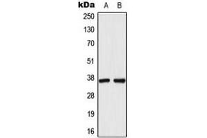 Western blot analysis of AKR1C1 expression in HeLa (A), HepG2 (B) whole cell lysates. (AKR1C1 Antikörper  (N-Term))
