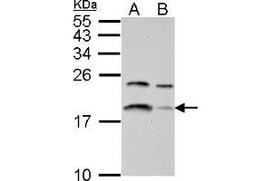 WB Image LC3B antibody detects LC3B protein by western blot analysis. (LC3B Antikörper)