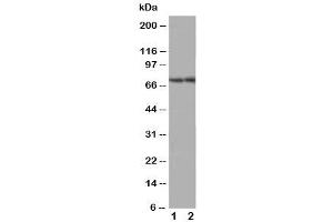Western blot testing of ABCG4 antibody (ABCG4 Antikörper  (Middle Region))
