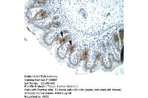 Human Stomach (ETV6 Antikörper  (C-Term))
