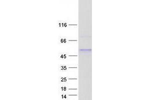 ZNF362 Protein (Myc-DYKDDDDK Tag)