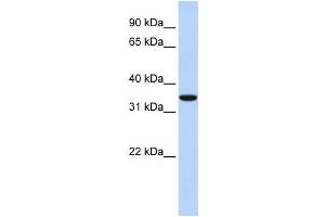 Western Blotting (WB) image for anti-Membrane-Associated Ring Finger (C3HC4) 1, E3 Ubiquitin Protein Ligase (MARCH1) antibody (ABIN2458722) (MARCH1 Antikörper)