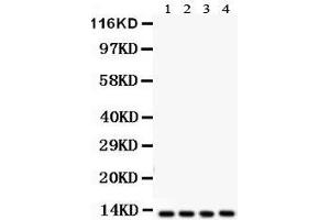 Anti-Cytochrome C antibody, Western blotting All lanes: Anti Cytochrome C  at 0.