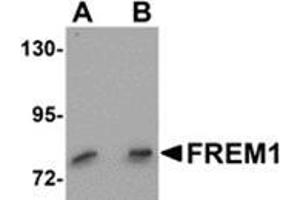 Western blot analysis of FREM1 in K562 cell lysate with FREM1 antibody at (A) 0. (FREM1 Antikörper  (C-Term))