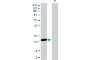 Western Blot analysis of PAGE4 expression in transfected 293T cell line by PAGE4 monoclonal antibody (M01), clone 7C3. (PAGE4 Antikörper  (AA 1-102))