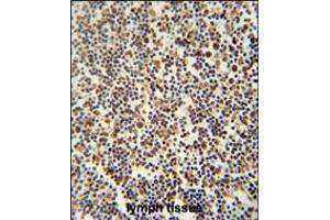 DENND1B antibody immunohistochemistry analysis in formalin fixed and paraffin embedded human lymph tissue followed by peroxidase conjugation of the secondary antibody and DAB staining. (DENND1B Antikörper  (N-Term))