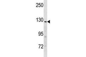 Insulin receptor R antibody western blot analysis in mouse heart tissue lysate (INSRR Antikörper  (AA 1228-1255))