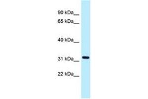Image no. 1 for anti-Asparagine-Linked Glycosylation 5, Dolichyl-Phosphate beta-Glucosyltransferase Homolog (S. Cerevisiae) (ALG5) (AA 87-136) antibody (ABIN6747831)