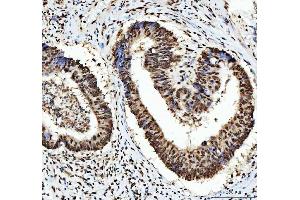 IHC analysis of HNRNPL using anti-HNRNPL antibody (ABIN4886624). (HNRNPL Antikörper  (C-Term))