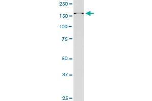 RAI1 monoclonal antibody (M01), clone 6H5. (RAI1 Antikörper  (AA 1-101))