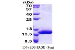 Chromosome 17 Open Reading Frame 37 (C17orf37) (AA 1-112) protein (His tag)