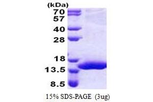 SDS-PAGE (SDS) image for Chromosome 17 Open Reading Frame 37 (C17orf37) (AA 1-112) protein (His tag) (ABIN5853168)
