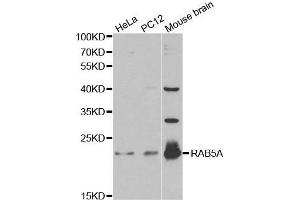 Western blot analysis of extracts of various cell lines, using RAB5A antibody. (RAB5 Antikörper  (AA 1-215))