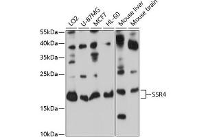 Western blot analysis of extracts of various cell lines, using SSR4 antibody (ABIN6133183, ABIN6148490, ABIN6148491 and ABIN6224060) at 1:1000 dilution. (SSR4 Antikörper  (AA 24-144))