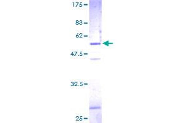 SNAP23 Protein (AA 1-211) (GST tag)