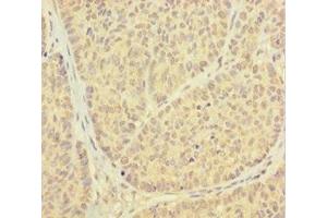 Immunohistochemistry (IHC) image for anti-Proteasome (Prosome, Macropain) Inhibitor Subunit 1 (PI31) (PSMF1) (AA 1-271) antibody (ABIN7164935)