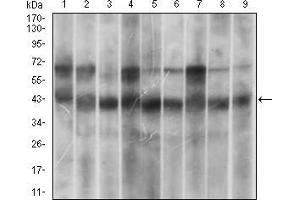 Western blot analysis using MAPK14 mouse mAb against Hela (1), HEK293 (2), A431 (3), MCF-7 (4), RAW264.