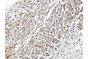 IHC-P Image Immunohistochemical analysis of paraffin-embedded SNU16 xenograft, using TUFM, antibody at 1:100 dilution. (TUFM Antikörper)