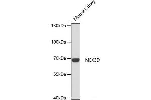 Western blot analysis of extracts of Mouse kidney using MEX3D Polyclonal Antibody at dilution of 1:1000. (MEX3D Antikörper)