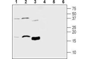 Western blot analysis of mouse brain lysate (lanes 1 and 4), rat brain lysate (lanes 2 and 5) and human recombinant MANF protein (lanes 3 and 6): - 1-3. (MANF Antikörper  (Mature))