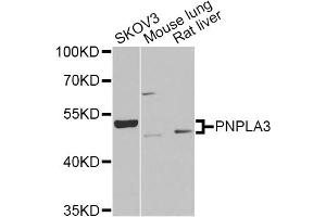Western blot analysis of extracts of various cell lines, using PNPLA3 Antibody (ABIN2564605) at 1:1000 dilution. (PNPLA3 Antikörper)