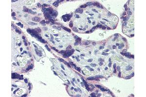 Anti-STAT5B antibody IHC of human placenta.
