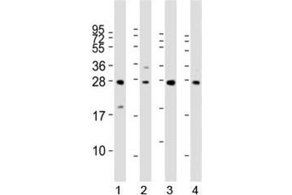 LIN28B Antikörper  (AA 95-128)