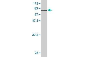 Western Blot detection against Immunogen (73. (ENO1 Antikörper  (AA 1-434))