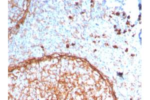 Immunohistochemistry (IHC) image for anti-Integrin alpha M (ITGAM) (AA 941-1074) antibody (ABIN6939813)
