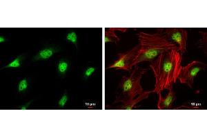 ICC/IF Image CDK4 antibody detects CDK4 protein at nucleus by immunofluorescent analysis. (CDK4 Antikörper)