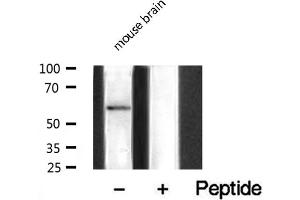 Western Blotting (WB) image for anti-UBX Domain Protein 11 (UBXN11) (Internal Region) antibody (ABIN6265864)