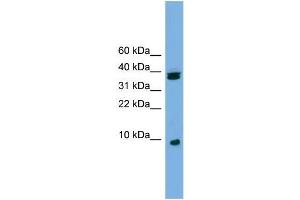 Human Jurkat; WB Suggested Anti-RPS21 Antibody Titration: 0. (RPS21 Antikörper  (Middle Region))