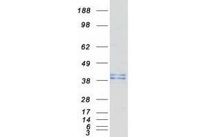 Western Blotting (WB) image for beta-1,3-Glucuronyltransferase 3 (Glucuronosyltransferase I) (B3GAT3) protein (Myc-DYKDDDDK Tag) (ABIN2715120)