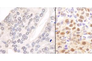 anti-Casein beta (CSN2) (AA 1-50) antibody
