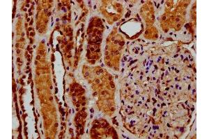 IHC image of ABIN7174060 diluted at 1:200 and staining in paraffin-embedded human kidney tissue performed on a Leica BondTM system. (RYK Antikörper  (AA 494-586))