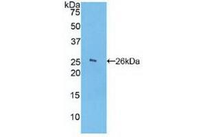 Detection of Recombinant FCN1, Human using Polyclonal Antibody to Ficolin 1 (FCN1) (FCN1 Antikörper  (AA 45-249))
