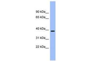 Image no. 1 for anti-Aminocarboxymuconate Semialdehyde Decarboxylase (ACMSD) (AA 251-300) antibody (ABIN6743386) (ACMSD Antikörper  (AA 251-300))