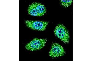 Confocal immunofluorescent analysis of K6 Antibody (Center) (ABIN656098 and ABIN2845441) with U-251MG cell followed by Alexa Fluor 488-conjugated goat anti-rabbit lgG (green). (PAK6 Antikörper  (AA 268-297))